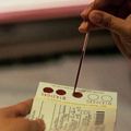 Мешканці Півдня України здають тест на ВІЛ найчастіше