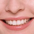 Британські зуби у 20 разів дорожчі за угорські